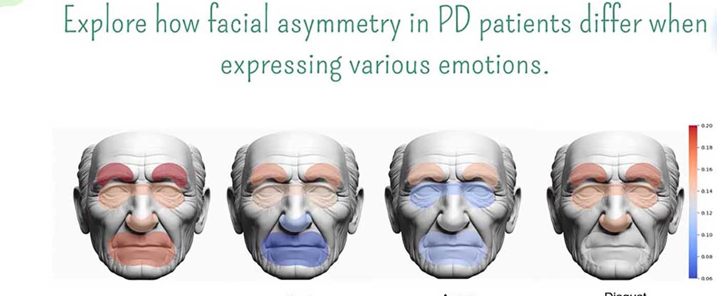 Designing a Smart System for Parkinson's Screening