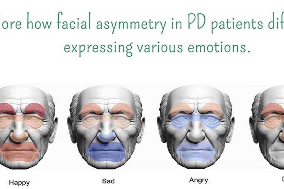طراحی و ساخت سیستم چندمولفه‌ای هوشمند غربالگری پارکینسون